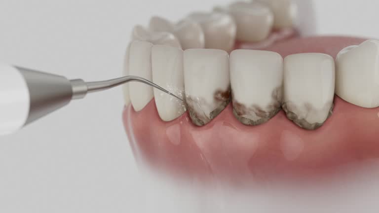Reliable Dental contractor in Indian Rocks Beach, FL by Dentist Open Now